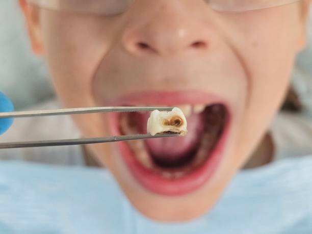 Best Emergency Dental Care for Sports Injuries in Wilson, PA